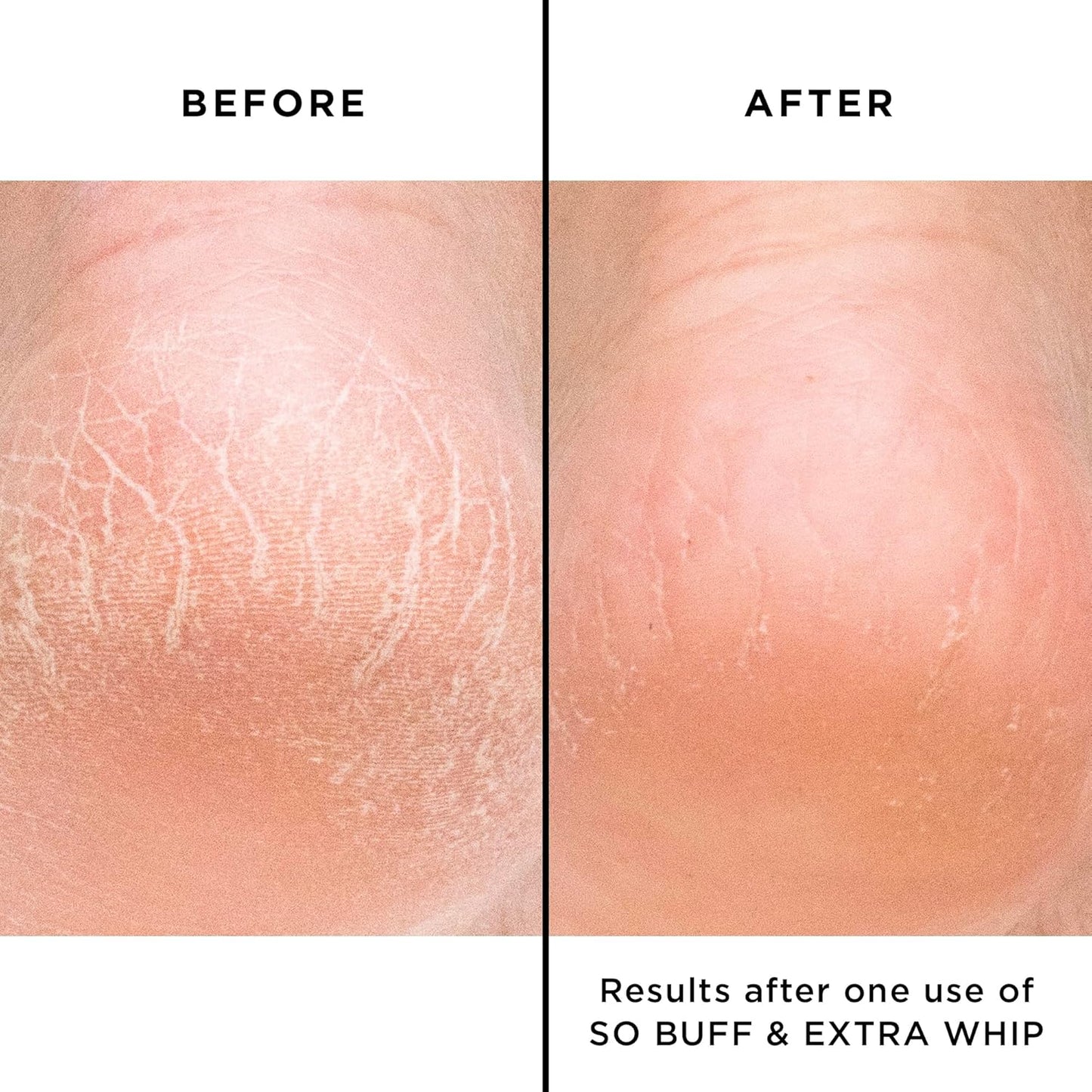 Hand & Foot Care Treatment Cream – Nourishing Repair Formula for Dry, Cracked Skin, 1 Oz